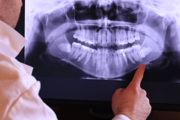 Best Cracked Tooth Emergency Dentist  in Union Springs, AL